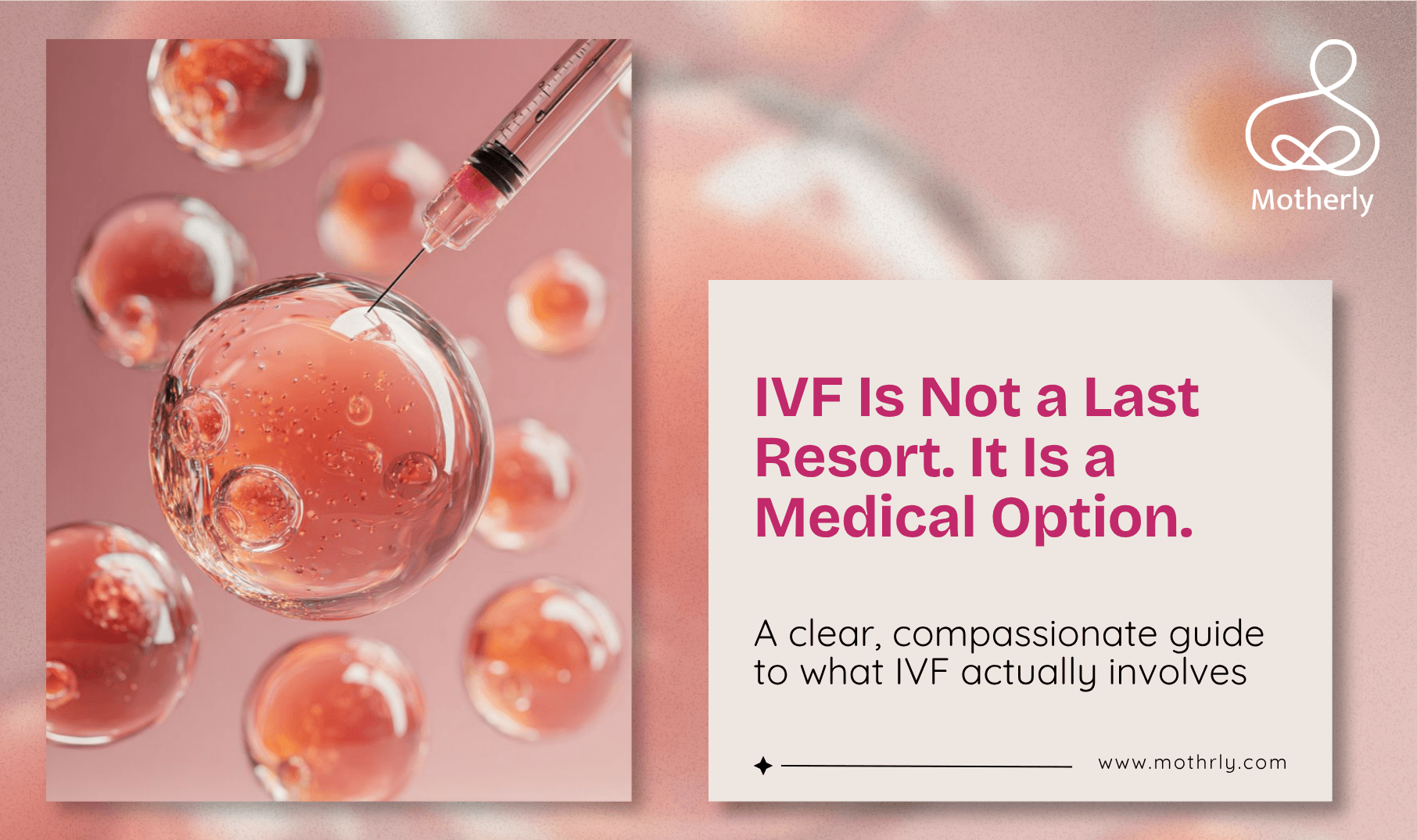 IVF Is Not a Last Resort. It Is a Medical Option. Here Is the Honest, Jargon-Free Guide Every Indian Woman Deserves Before She Decides.