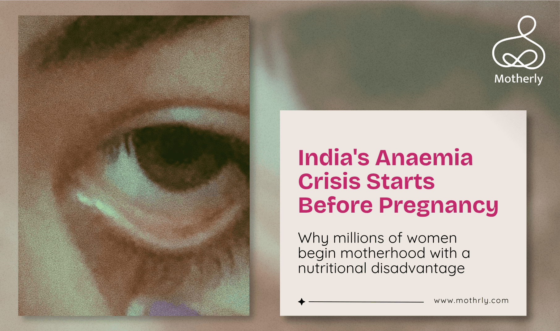 71% of Indian Women Are Anaemic Before They Get Pregnant. This Is Not a Statistic. This Is a Crisis That Is Harming Mothers and Babies Right Now.