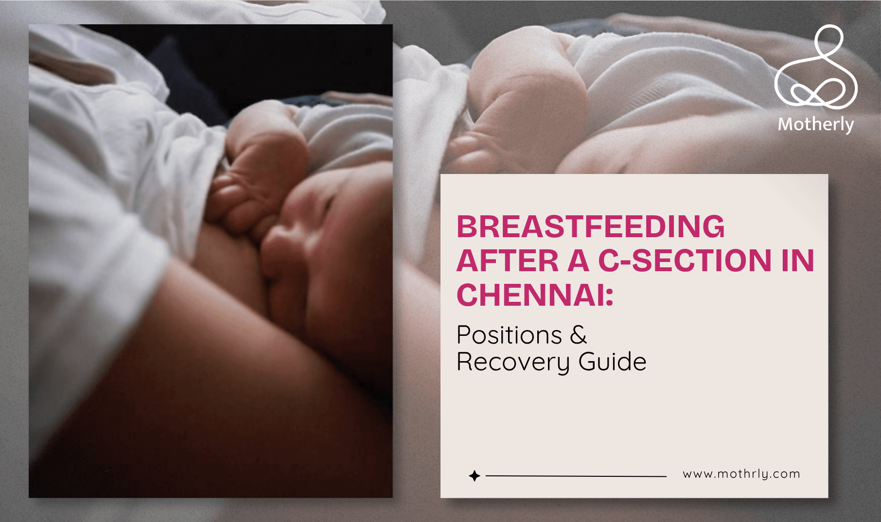 Breastfeeding After a C-Section in Chennai: Positions & Recovery Guide