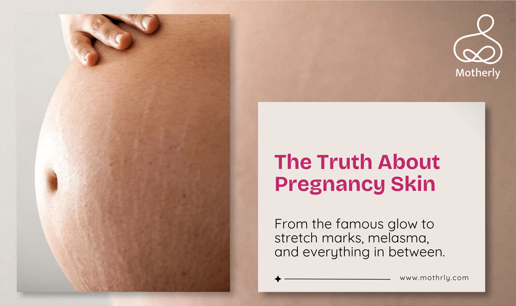 Pregnancy Glow Is Real. But So Are Melasma, Stretch Marks, and Hair Loss. The Complete Truth About Your Skin During Pregnancy.
