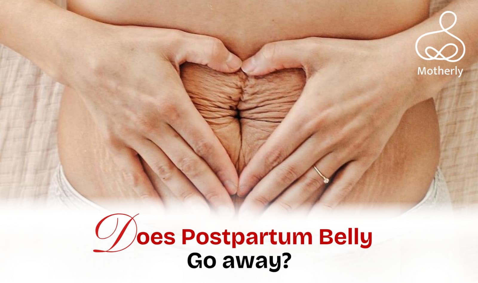 DOES POSTPARTUM BELLY GO AWAY